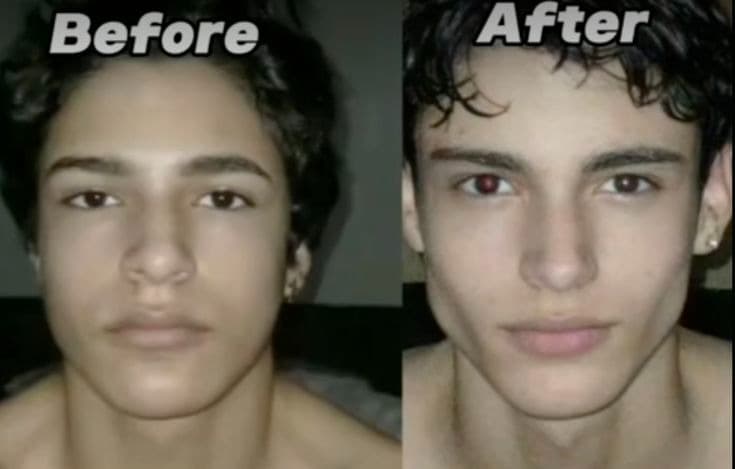 Nikhil K. Jawline Glow-Up transformation Before and After